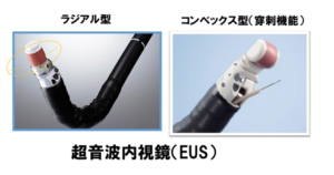 膵臓の超音波内視鏡